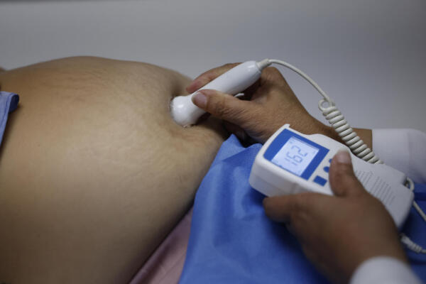 Una mujer embarazada es atendida por personal médico, en una fotografía de archivo. EFE/ Bienvenido Velasco