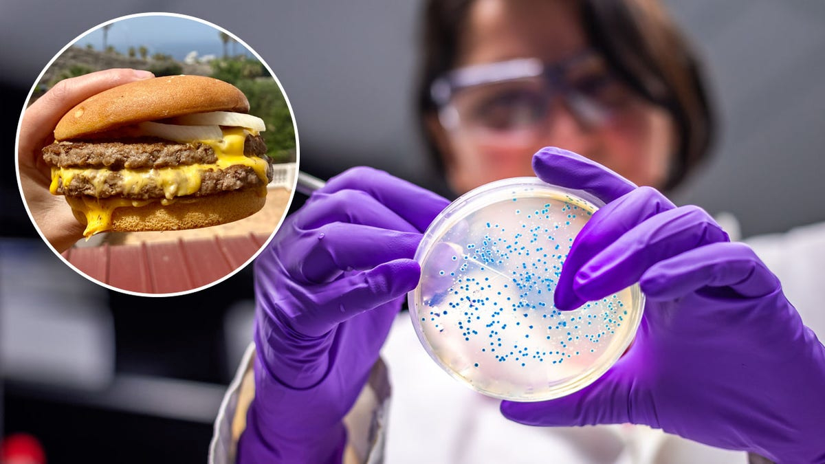 La "bacteria come carne" entra por heridas, no por comida
