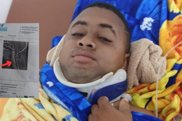 El joven presenta fracturas en varias vértebras. Foto Fuente externa 