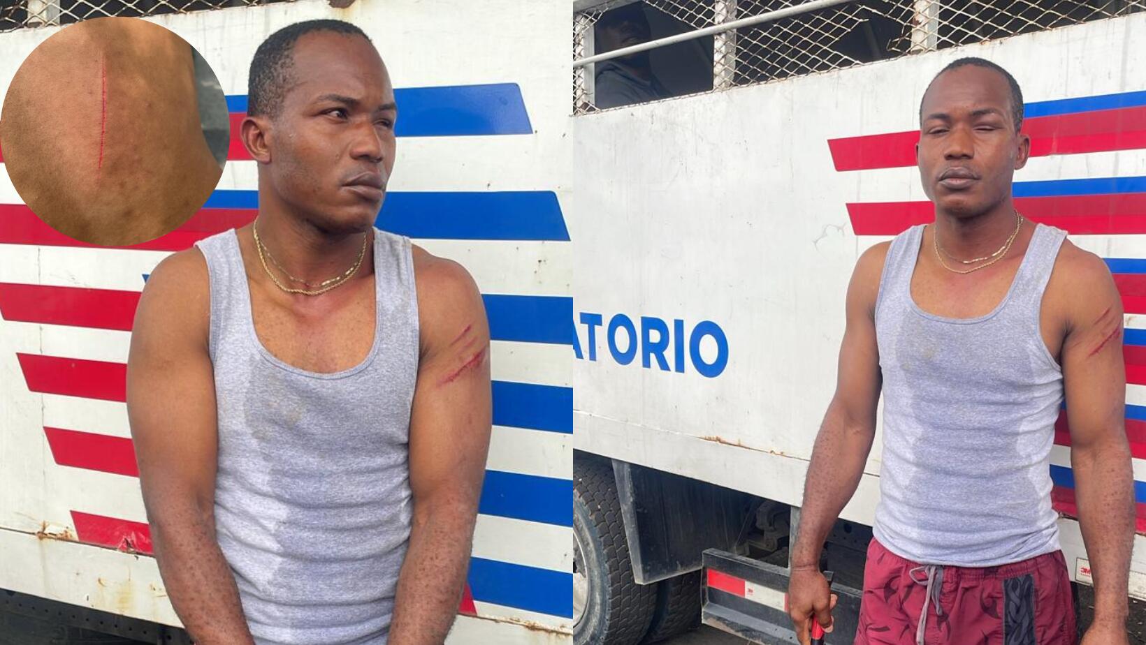 Agente de Migración resulta herido por nacional haitiano durante operativo en Baní 