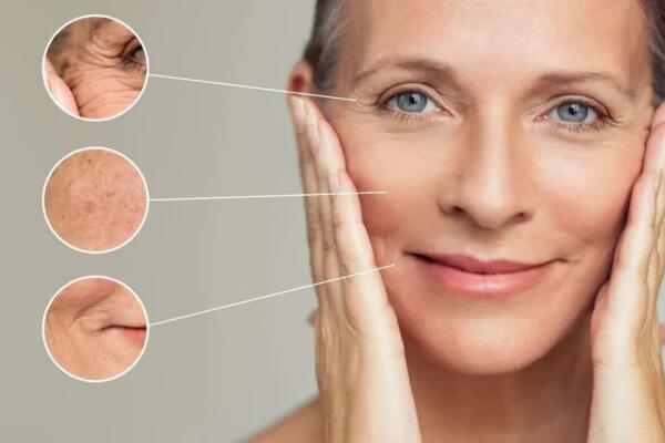 Botox, hialurónico y bioestimuladores: ¿qué debo saber sobre inyectables estéticos antes de aplicarlos?