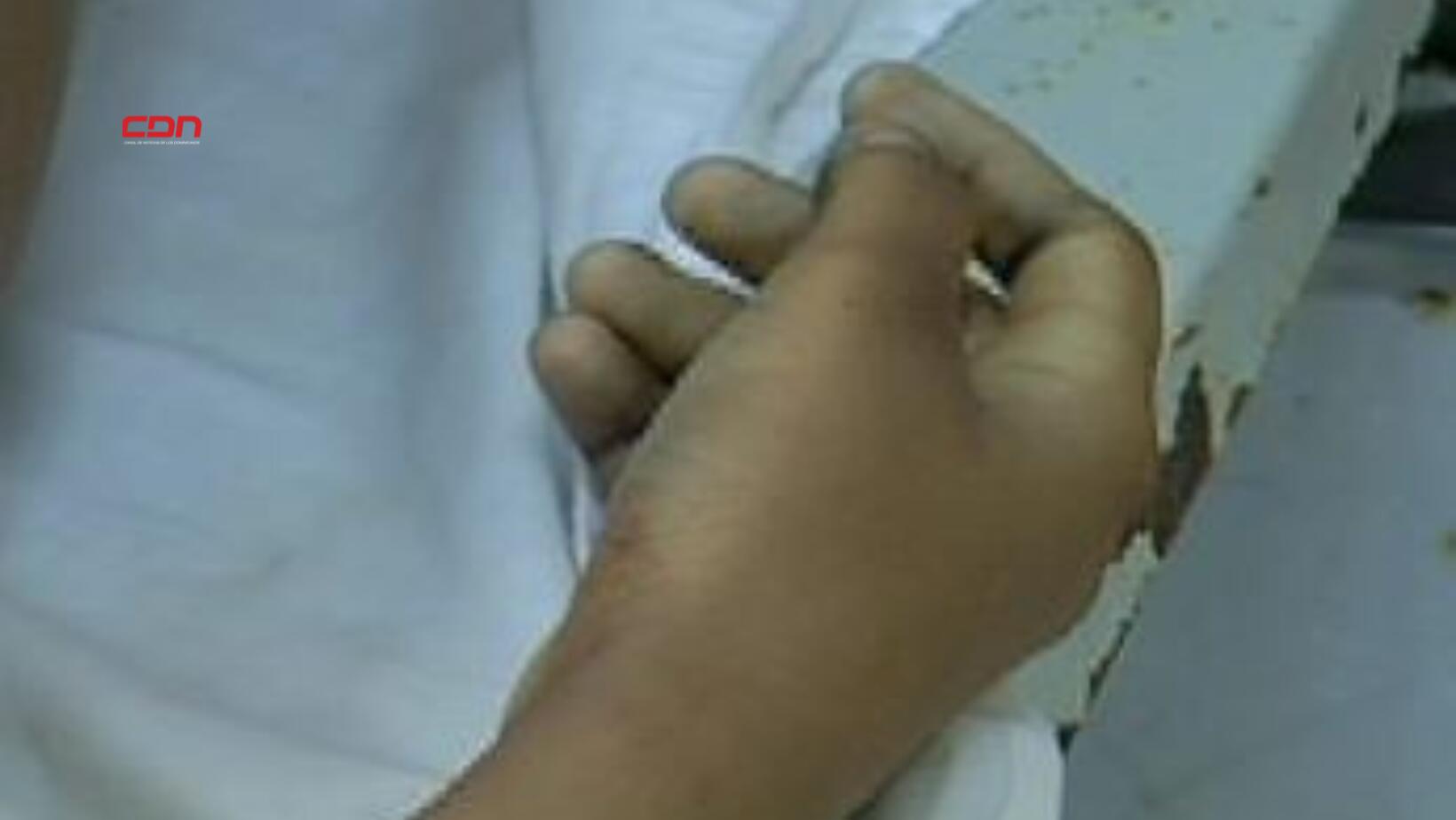 Herir con un pico