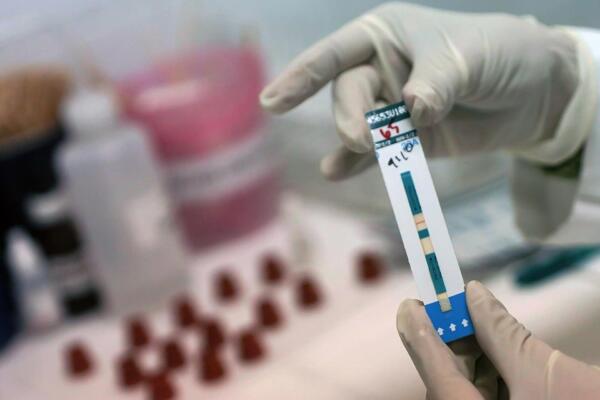 Lenacapavir, la nueva profilaxis que promete frenar el VIH
