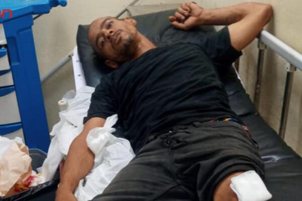 Jorge Leonardo Pérez Feliz, quien resultó herido por desconocidos.
