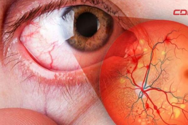 La especialista subrayó que el aumento de casos de diabetes en el país responde no solo a la herencia genética, sino también a los estilos de vida actuales.