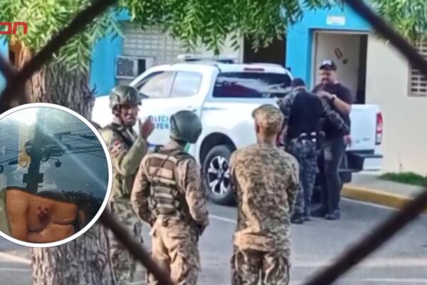 Las autoridades confirmaron que el interno herido recibió impactos de perdigones de balas de gota. 
