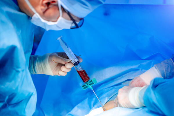 RD avanza en protocolos de trasplante con nuevos procedimientos para células progenitoras hematopoyéticas