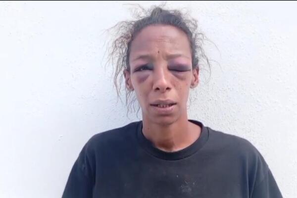 Joven denuncia brutal agresión y abuso sexual en Moca 