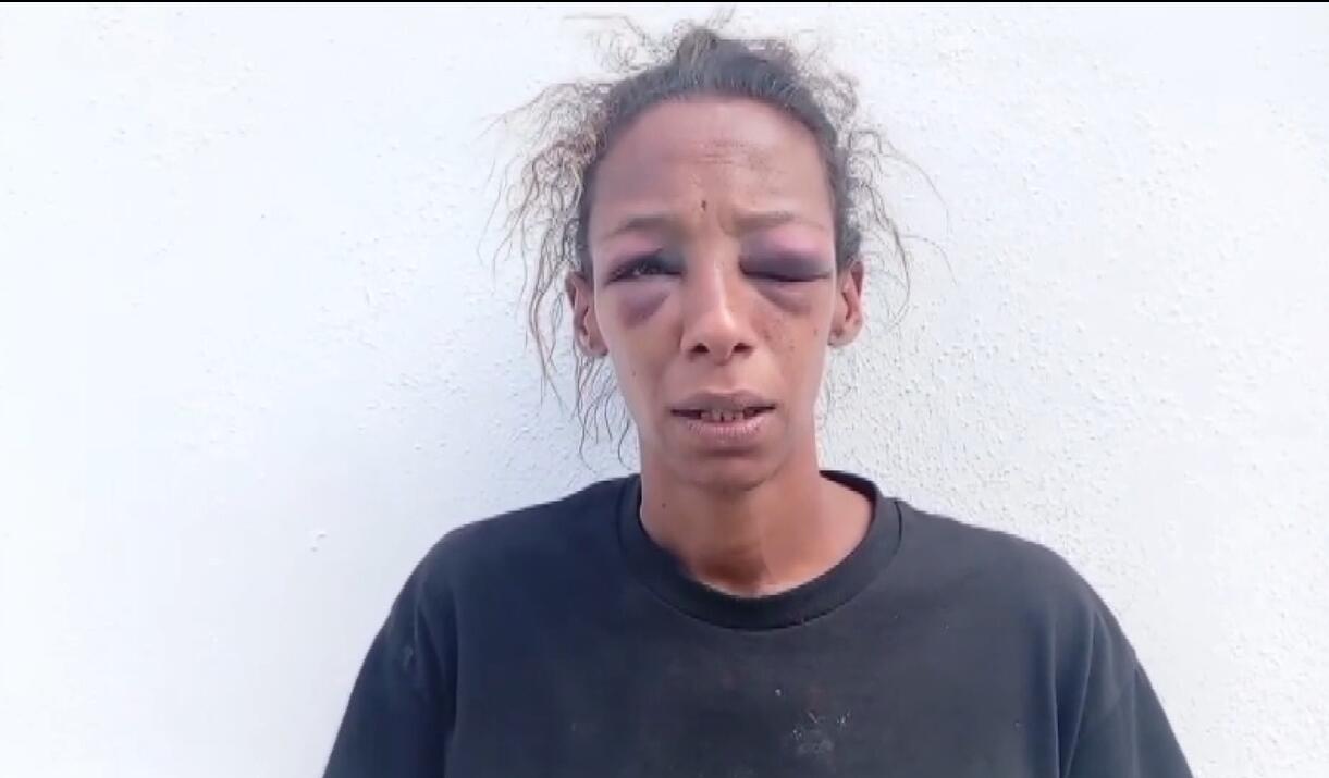 Joven denuncia brutal agresión y abuso sexual en Moca