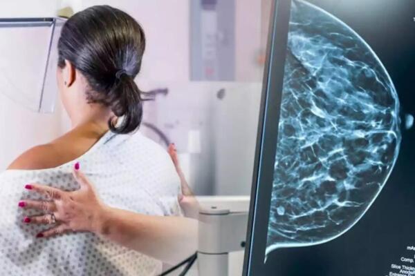 Los cribados (o screening) son pruebas médicas aplicadas a personas sanas (sin síntomas) para detectar precozmente enfermedades, como el cáncer de mama o colon.