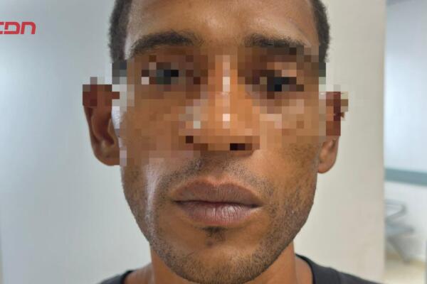 Cristian Martes Frías, alias “Oreja”, apresado por presunto robo. 