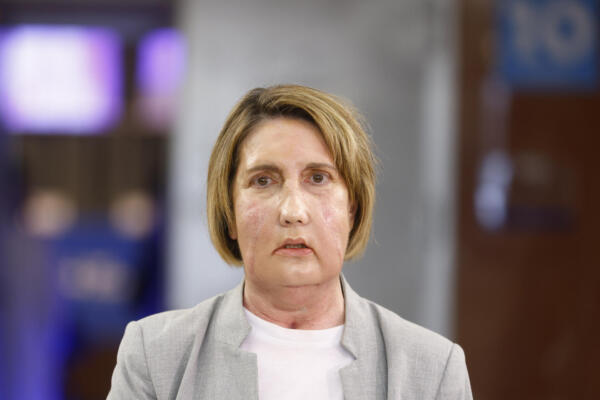 Carmen, la primera paciente en recibir un trasplante de cara de una donante que recibió una eutanasia, posa para los medios de comunicación antes de la rueda de prensa que se ha celebrado en el Hospital Vall d'Hebron de Barcelona para explicar el procedimiento. EFE/Quique García