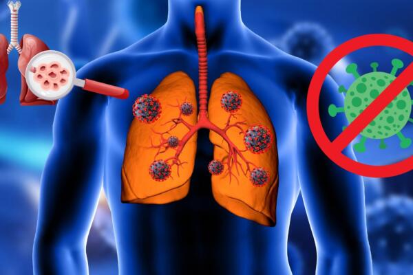 Fundación Dominicana de Fibrosis Quística advierte sobre el alto costo del tratamiento y llama a fortalecer el apoyo estatal a pacientes con esta enfermedad rara.