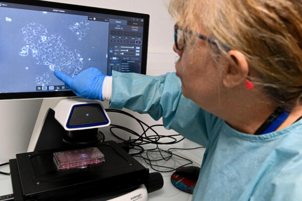 La profesora-investigadora Maryvonne Ardourel señala una célula de cáncer de páncreas en una micrografía mostrada en una pantalla en el laboratorio Inserm ART-RNAm del CHR (Centro Hospitalario Regional), en Orleans, centro de Francia, el 18 de noviembre de 2025. (Foto de JEAN-FRANCOIS MONIER / AFP)
