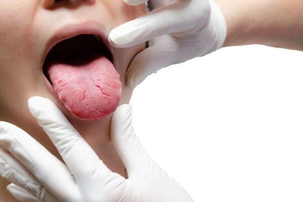 Tu lengua puede revelar más sobre tu salud. Cambios en su color, textura o humedad podrían ser señales de que algo no anda bien en tu cuerpo.