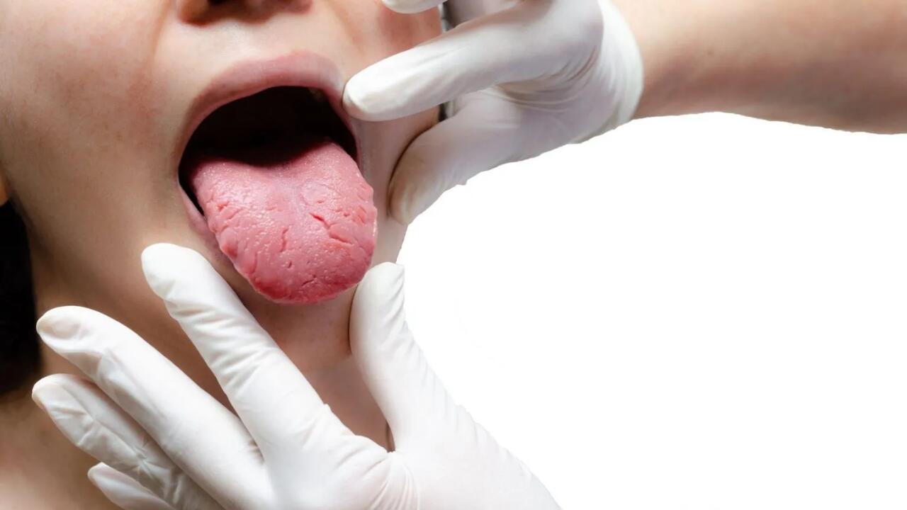 lengua