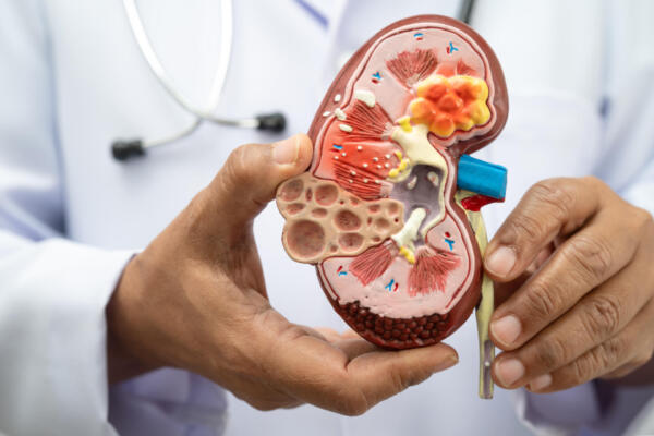 La prevención y la detección temprana son fundamentales para proteger la salud de los riñones y evitar complicaciones graves a largo plazo.