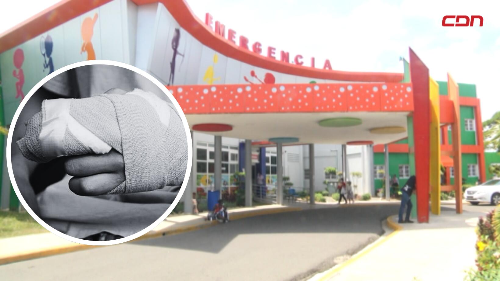 menor ingresada por quemaduras