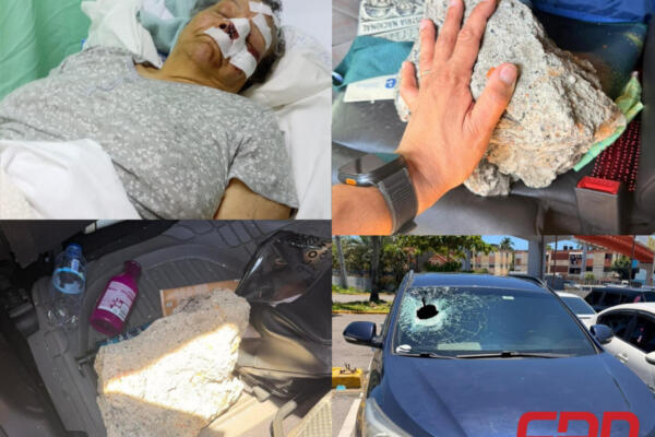 Mujer de 79 años recibe 30 puntos en el rostro tras ataque con peñón a vehículo en SDE
