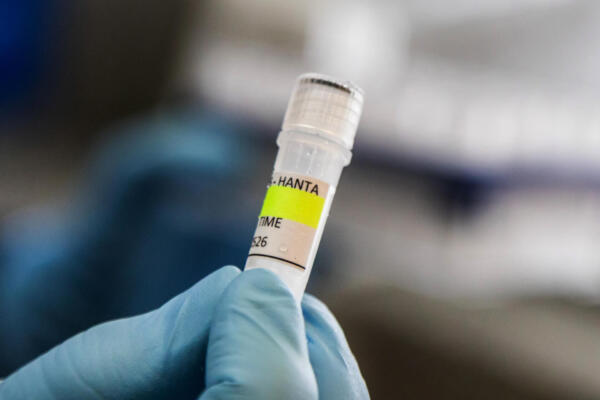Esta fotografía, distribuida por el Ministerio de Salud de Argentina, muestra a un científico del Instituto Malbrán sosteniendo un recipiente utilizado para diagnosticar el hantavirus andino.