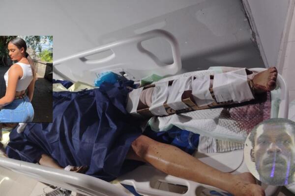 La joven de 20 años y cinco meses de embarazo permanece en estado delicado tras ser embestida por un nacional haitiano en Villas Agrícolas.