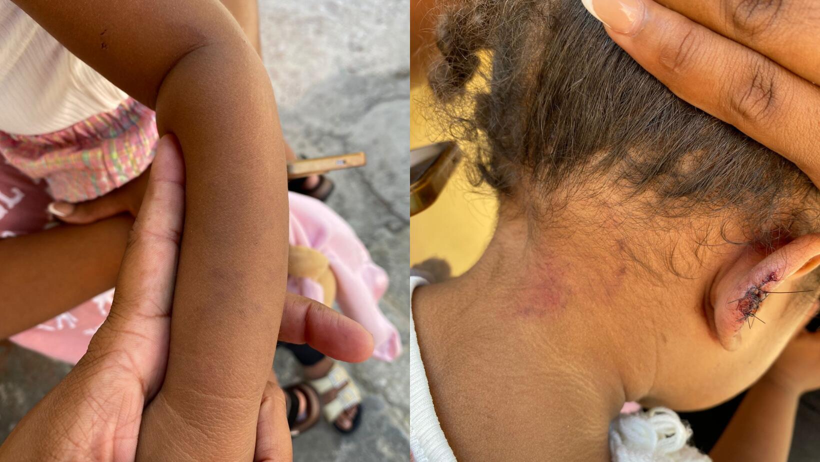 Maltrato a niña