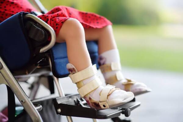 Familias de niños con atrofia muscular exigen acceso a medicamentos de alto costo