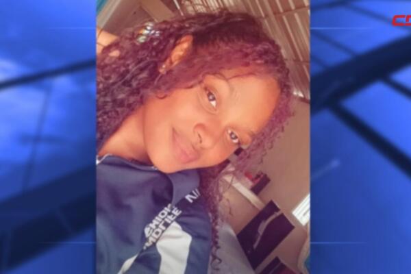Investigan disparo en Esperanza que dejó a una joven en condición grave.

