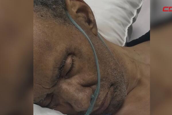 Solidaridad urgente para paciente con linfoma cerebral en UCI.
