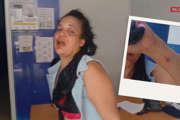 Delcy Rodríguez, joven agredida por su pareja en Moca.