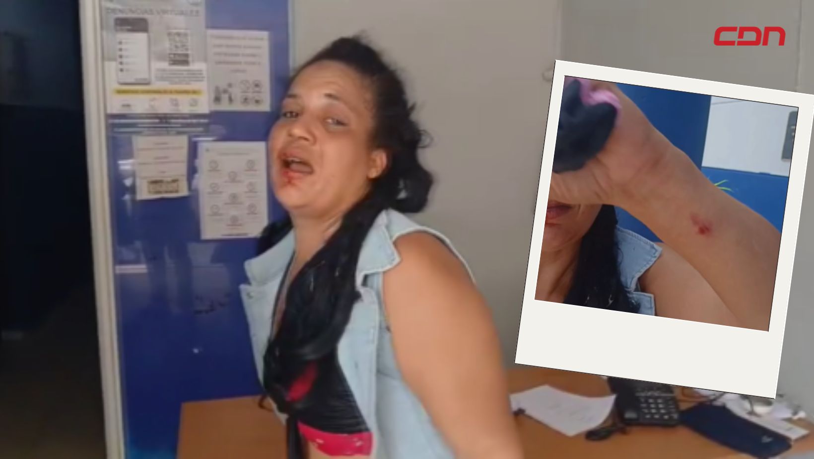 Joven agredida en Moca