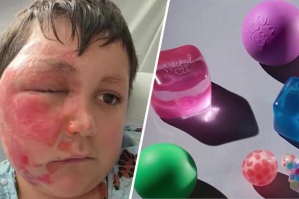 Autoridades alertan sobre el reto viral de calentar juguetes NeeDoh en microondas, tras varios casos de niños con graves quemaduras en EE. UU. / Foto: externa