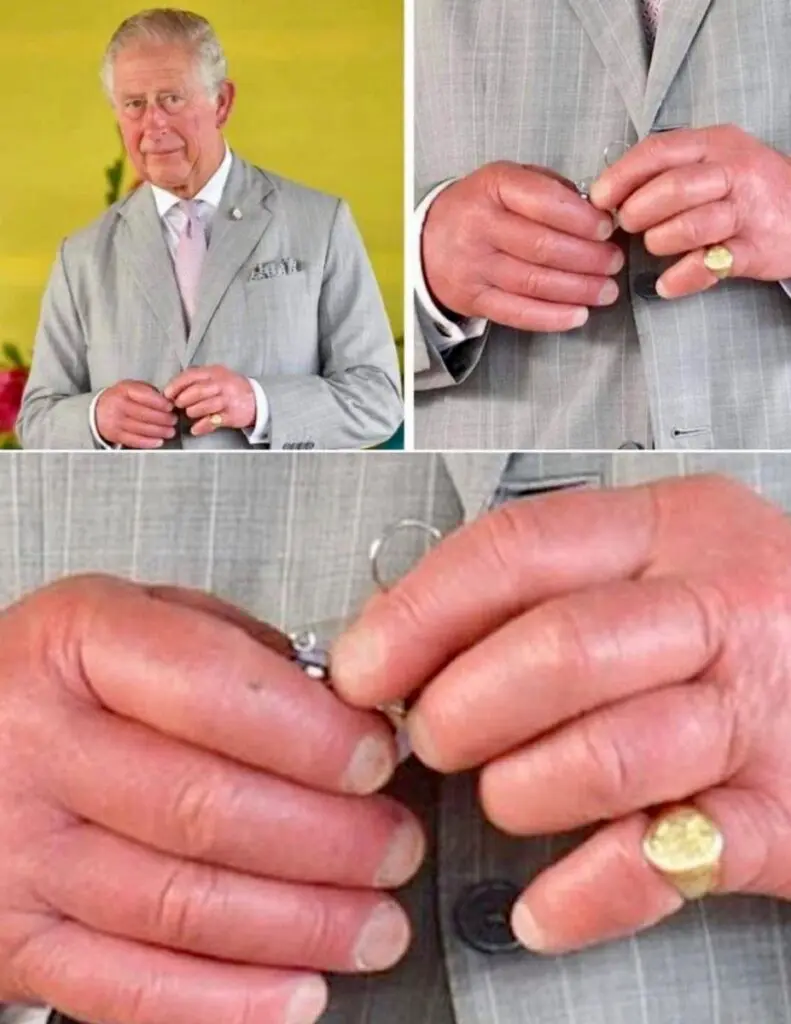 Las manos hinchadas del rey Carlos III prenden alarmas sobre su salud