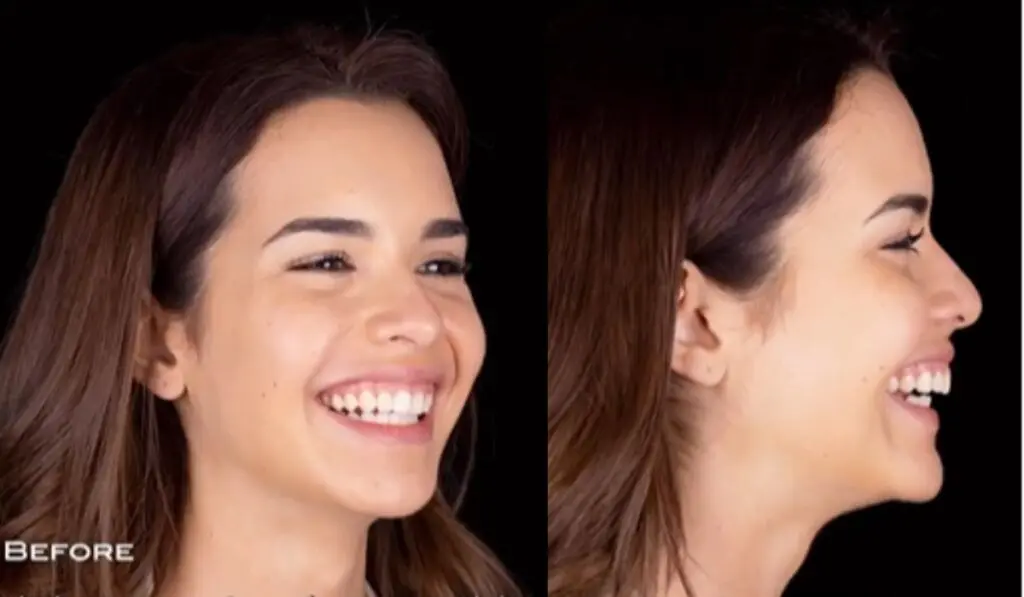 Así lucía Amanda Dudamel, Miss Venezuela, antes de sus cirugías
