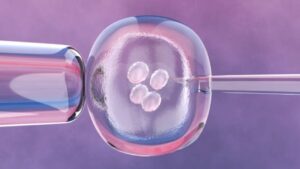 Usar esperma congelado en fecundación in vitro logra los mismos resultados que el semen fresco, según un estudio hecho