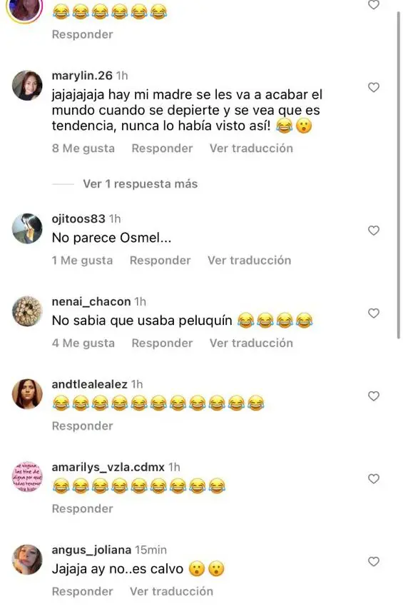 Las redes sociales explotan al ver a Osmel Sousa sin peluquín