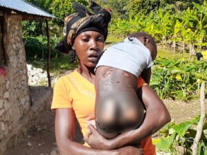 Madre sin dinero para combustible de ambulancia transportará hija