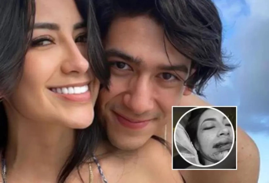 La brutal agresión que recibió una modelo e influencer por parte del novio