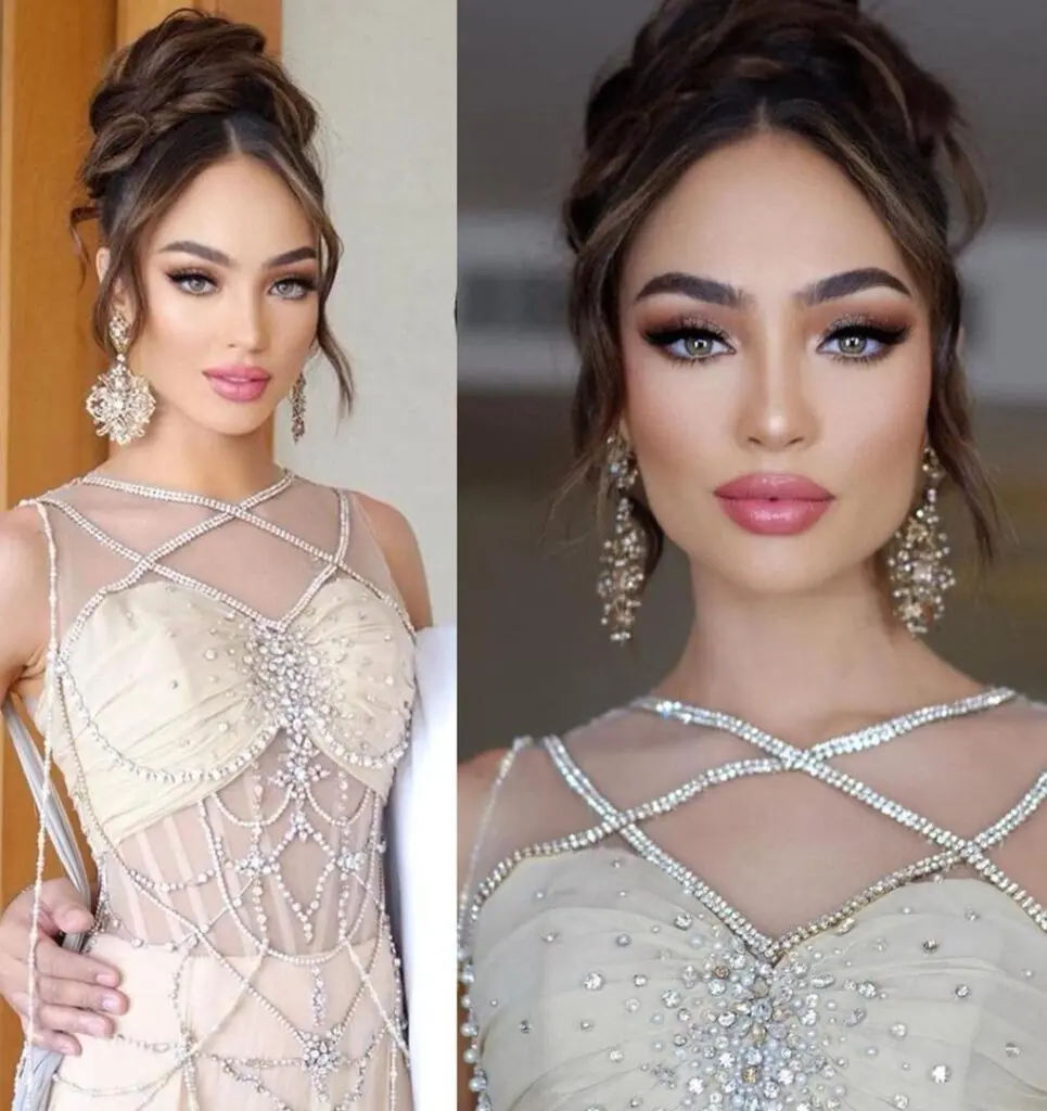 Miss Universo 2022 se operó el rostro y ahora luce irreconocible