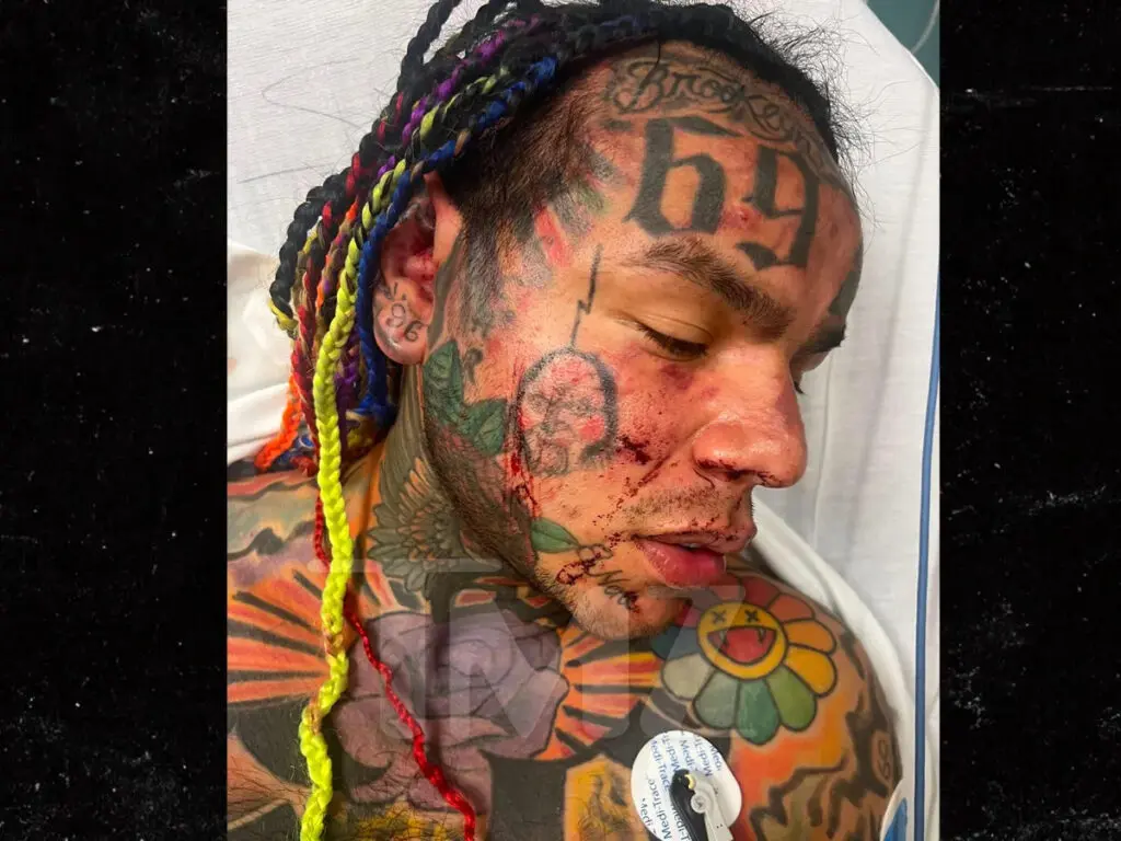 Tekashi 6ix9ine hospitalizado de emergencia tras recibir brutal golpiza en Florida