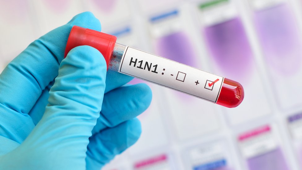 Perú detecta un brote de influenza H1N1 en Lima y otras regiones del país