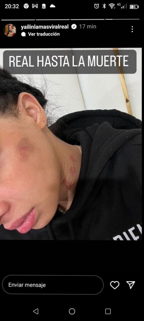 Yailin acusa a Anuel AA de violencia y sube foto golpeada
