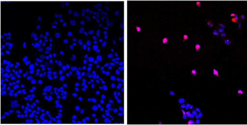 Científicos de EEUU desarrollan píldora para destruir tumores con cáncer