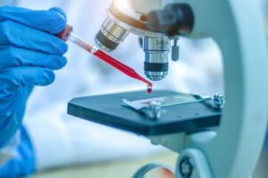 Alzheimer: un análisis de sangre en la mediana edad podría predecir la enfermedad