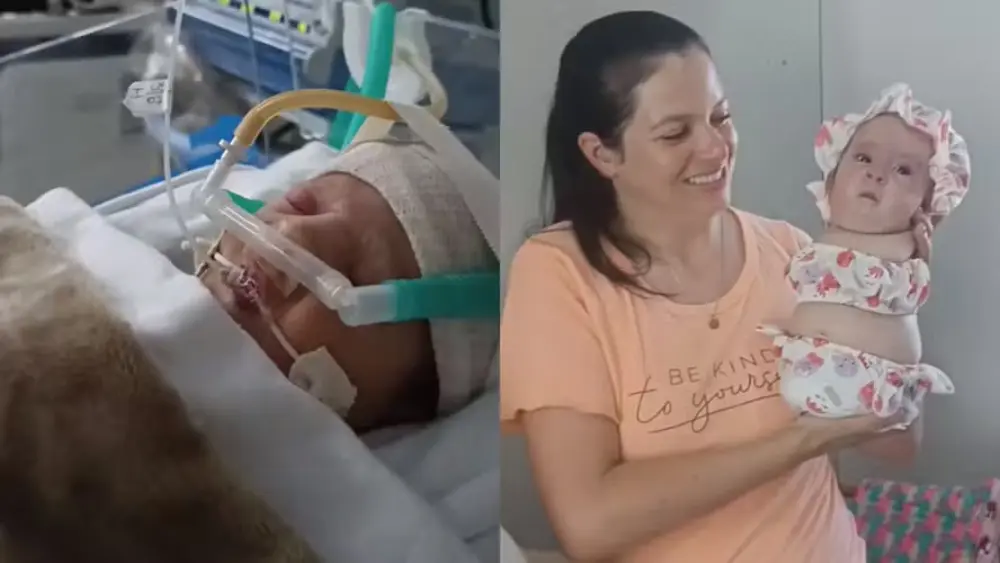 Ayla, la niña que nació sin piernas ni brazos y roba el corazón de todos