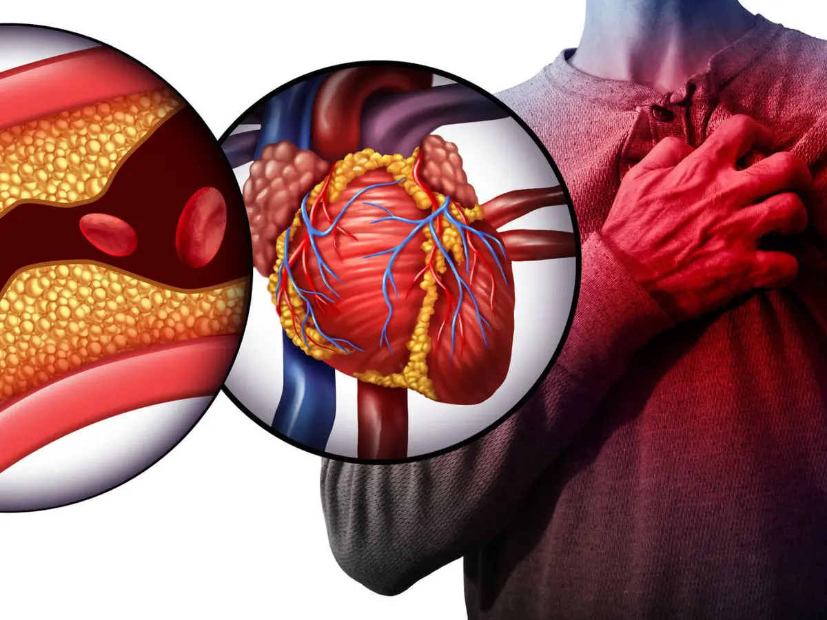 Vitamina que regula el colesterol y ayuda a proteger el corazón