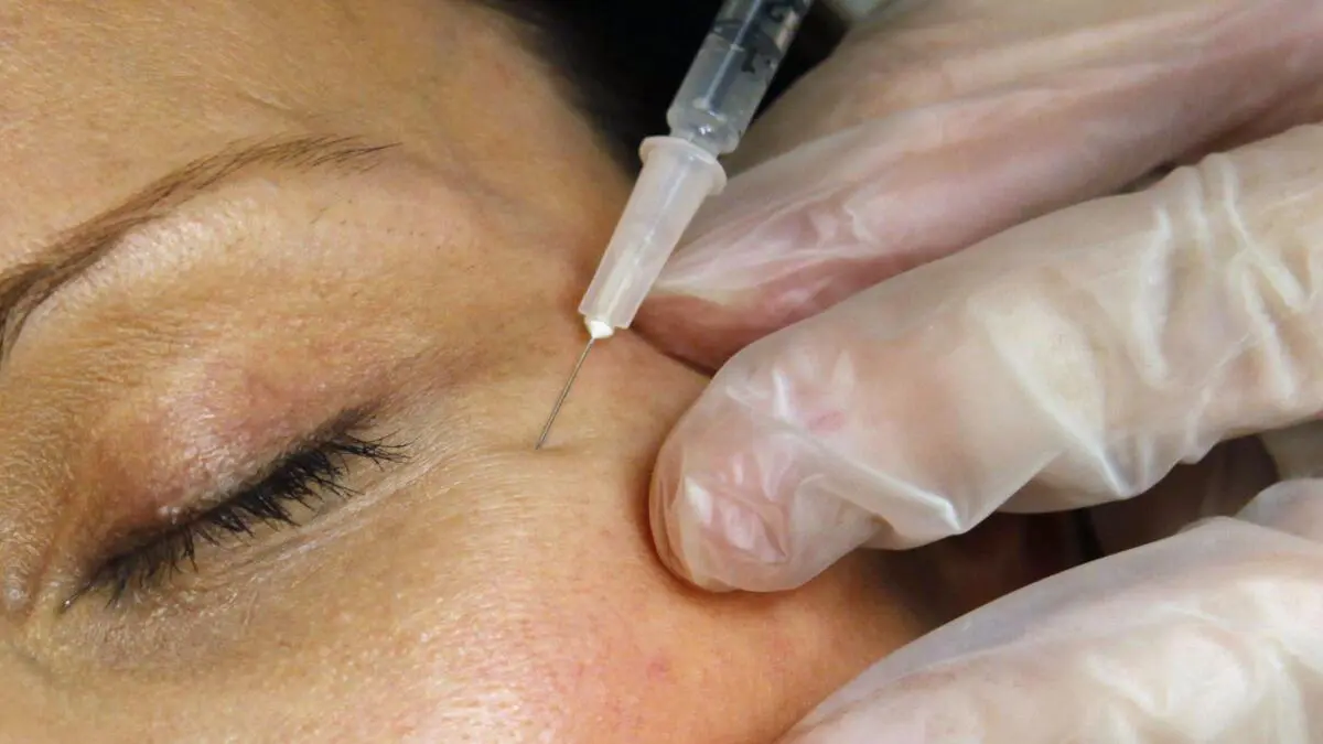 Funcionarios de salud de EEUU advierten sobre inyecciones falsificadas de Botox