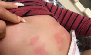 Mujer pide ayuda para condición de su hijo