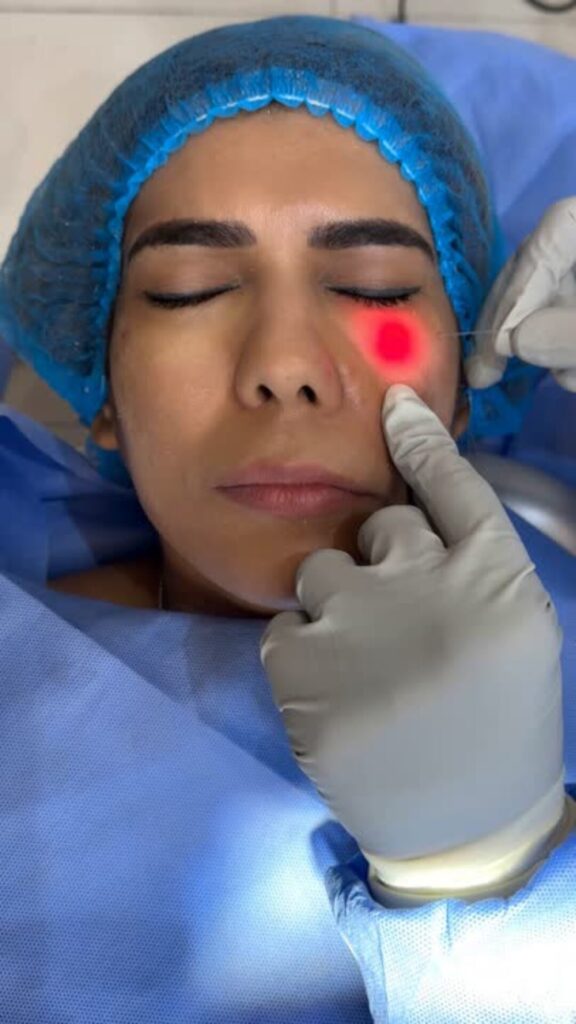 Láser Lifting: la tecnología que rejuvenece tu piel sin cirugía