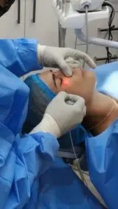 Láser Lifting: La Tecnología que Rejuvenece tu Piel Sin Cirugía